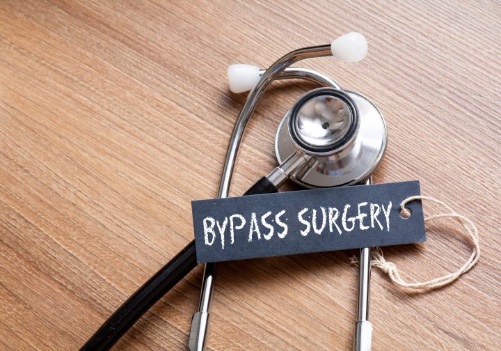 Bypass Surgery in Kerala